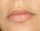 limpo