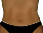 Bronzeamento